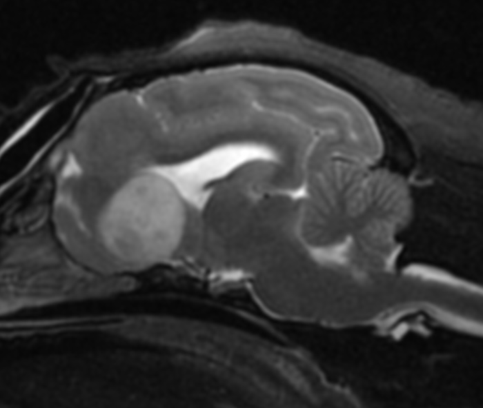 MRI study of a brain